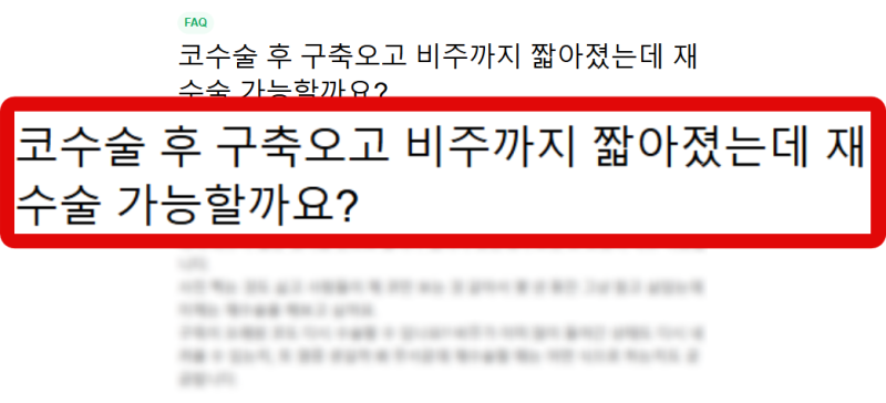 들창코성형 수술 병원 고를 때 체크 포인트 사진 4